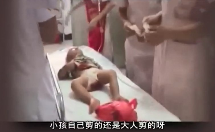 17月大男孩生殖器被剪,功能几乎完全丧失,凶手竟是孩子亲生母亲 sunbet官网app下载