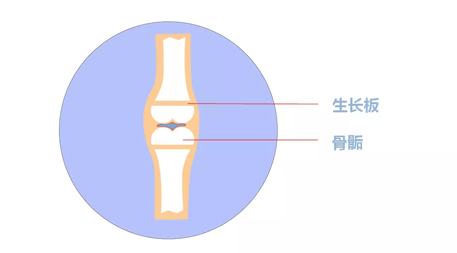 骨骺线是指长骨干骺端与骨骺之间的一盘软骨结构,又称为生长板,在孩子