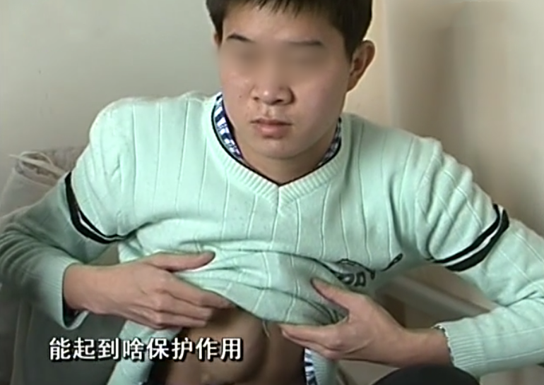                     男子心脏外露24年，肉眼可见血管和动脉，为遮挡夏天穿两件衣服
