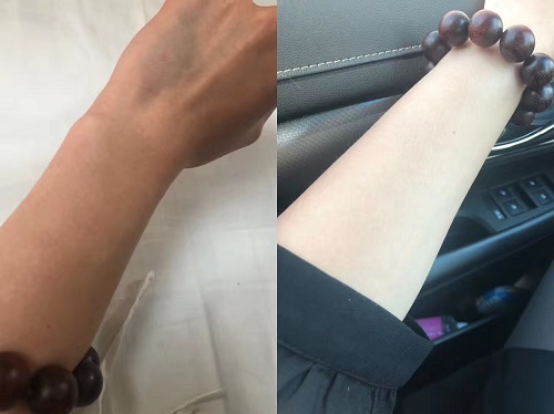 揭秘美白窍门 Pearlis美白片到底是什么 效果到底怎么样 Pearlis