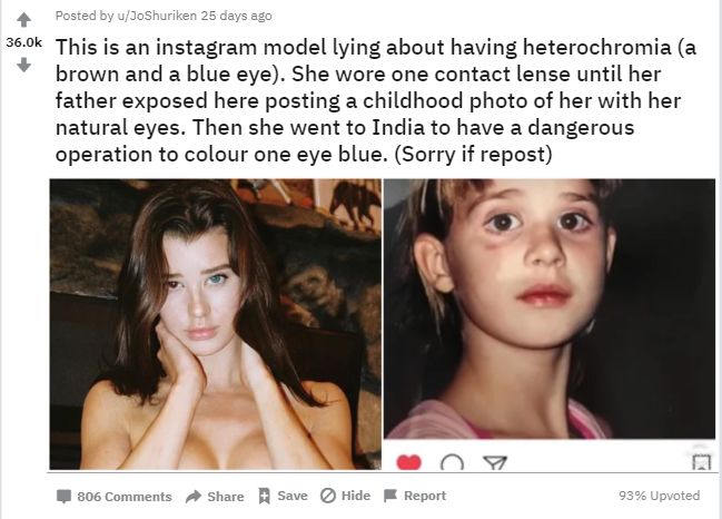 Is it true that Sarah McDaniel is faking about her heterochromia