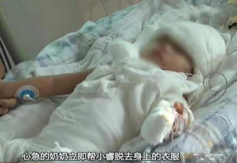                     奶奶给孙子洗澡，孙子不慎掉进热水，奶奶小动作将其身上的皮剥落