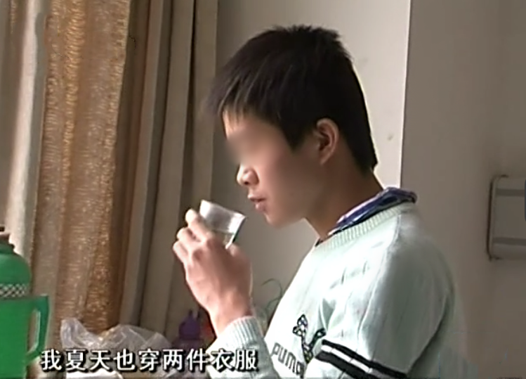                     男子心脏外露24年，肉眼可见血管和动脉，为遮挡夏天穿两件衣服