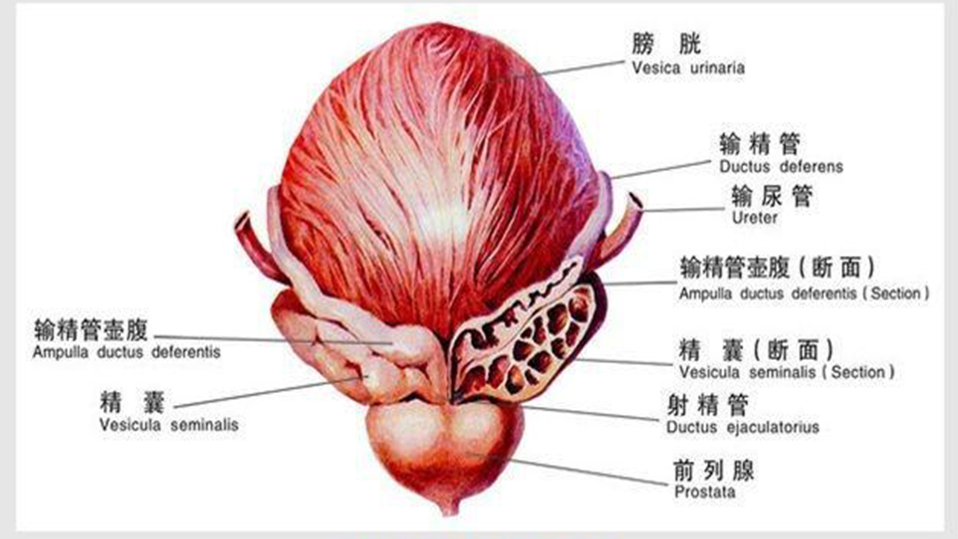 前列腺钙化的危害有哪些?