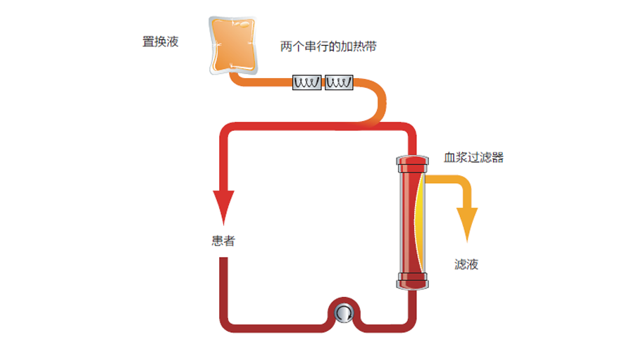 万物皆可盘盘点单重血浆置换及双重血浆置换下篇