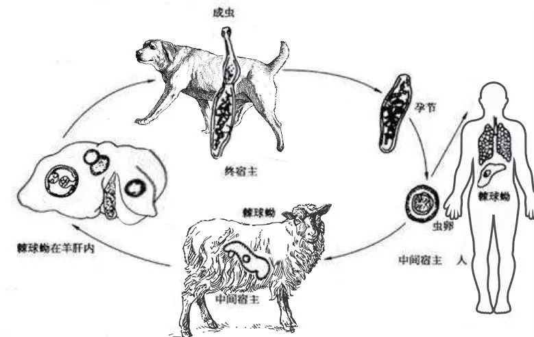 特约稿件:肺包虫病在中国 | 作者面对面