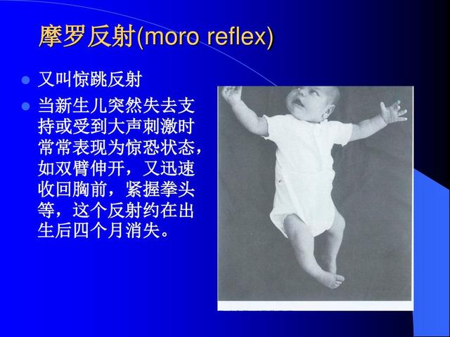                     宝宝睡觉易惊醒？这些原因不容忽视，妈妈须知这5点改善方法