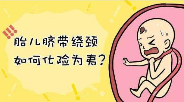                    胎儿脐带绕颈太恐怖？宝妈们别紧张，这样做准没问题