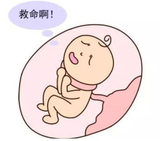                     胎儿脐带绕颈太恐怖？宝妈们别紧张，这样做准没问题