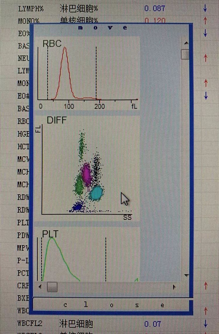 白细胞散点图有多重要,看了就知道