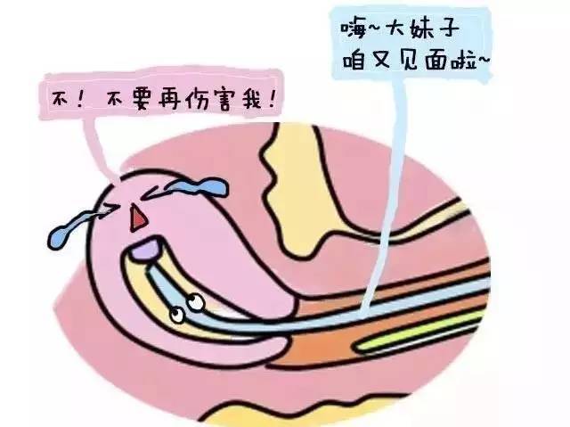 什么是人流清宫 49b5c32a38cd4db796770e5f005abec0.jpeg