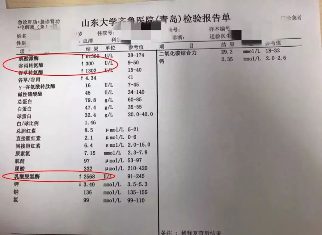 肌酸激酶,乳酸脱氢酶以及肝酶明显升高,诊断为"横纹肌溶解症"