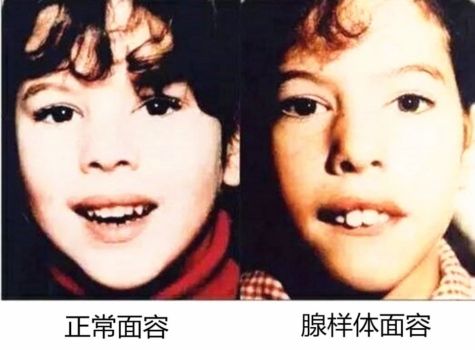                     原创            想早早地破坏孩子的颜值，做这3件小事就够了