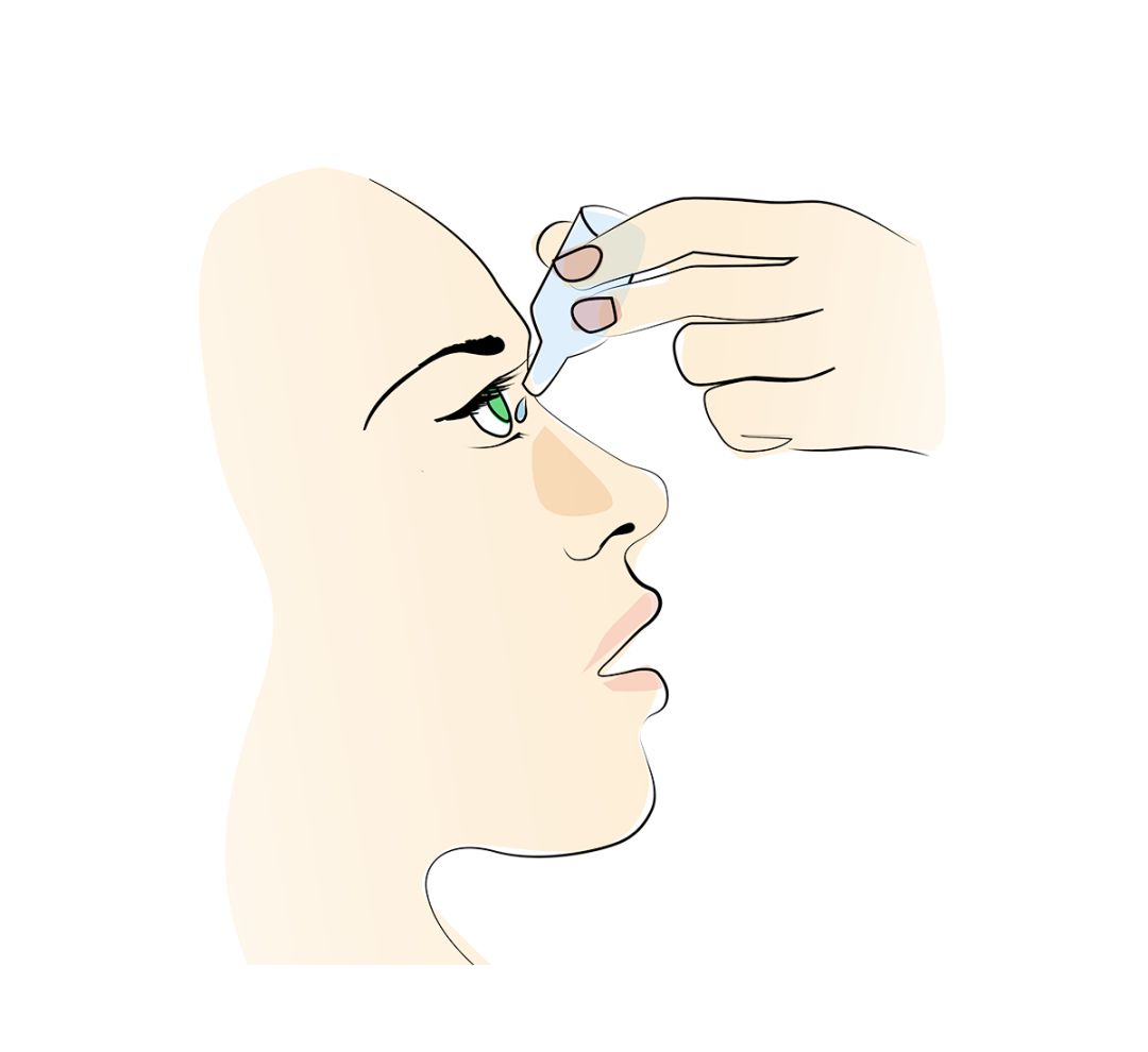 很多人滴眼药水滴错了白白浪费还没用应该这样滴