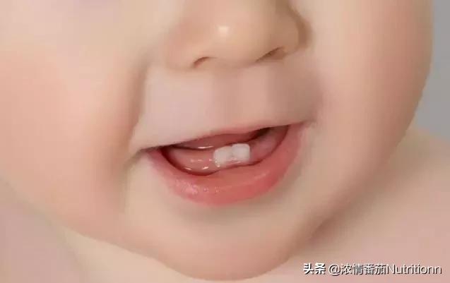                     一月黄疸，二月肠绞痛，三月抬头，宝宝必经之路赶紧了解