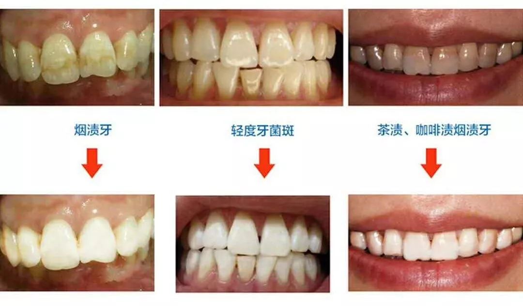 牙买家人口_人口普查(3)