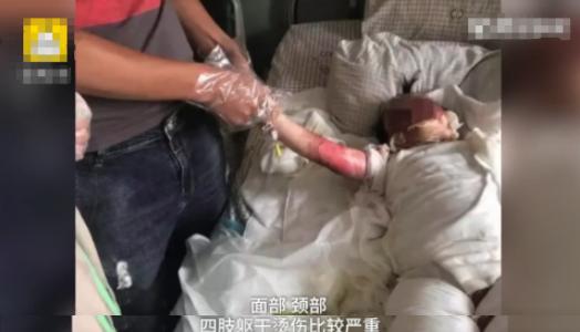                     2岁女童翻进170度油锅，哭声撕心裂肺，随后妈妈竟活剥一层皮
