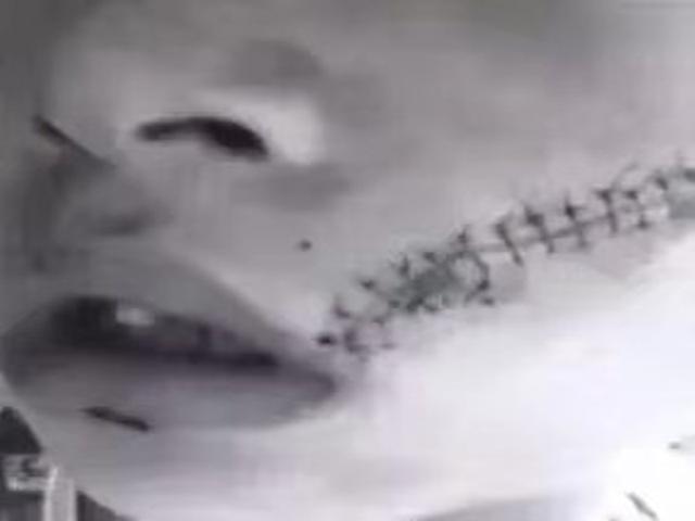                     妈妈放在茶几的酸奶，1天后，成了把孩子送进了医院的“炸弹”