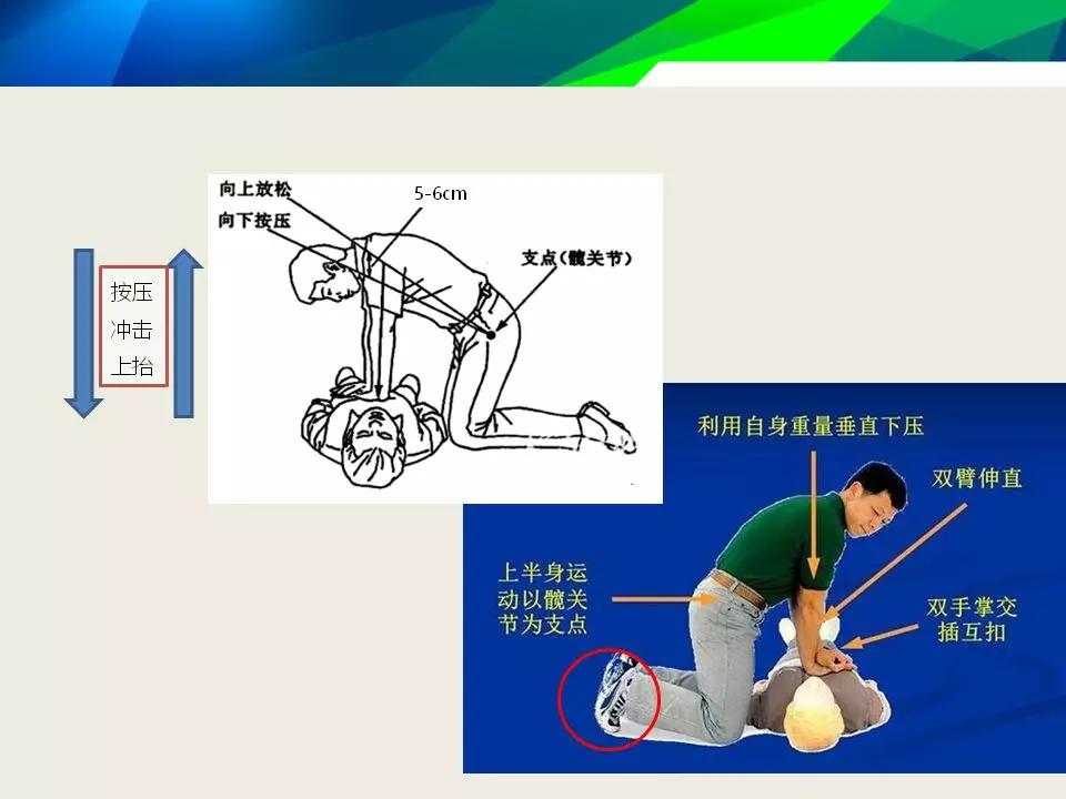 原创高质量心肺复苏的达成