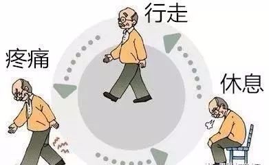 Ⅱ期:间歇性跛行期行走一段距离后,出现患肢疲劳,酸痛,被迫休息一段