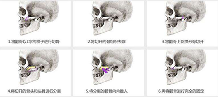 换头手术真的存在吗 c8626005a9bd412183c13d7bea37595d.jpeg