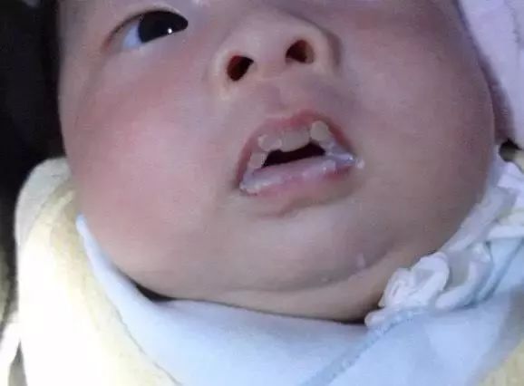                     外婆用偏方给孙女洗了个头，几分钟后女孩就头晕呕吐，竟然中毒了