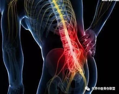 什么是棘间韧带损伤