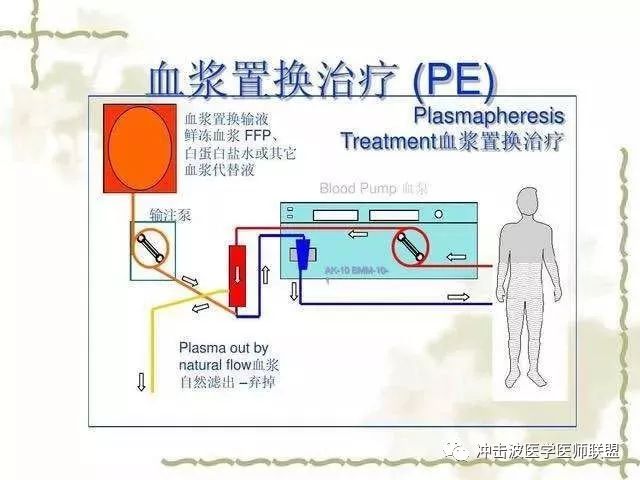 pe血浆置换的诊疗范围扩展至神经系统疾病等200多种