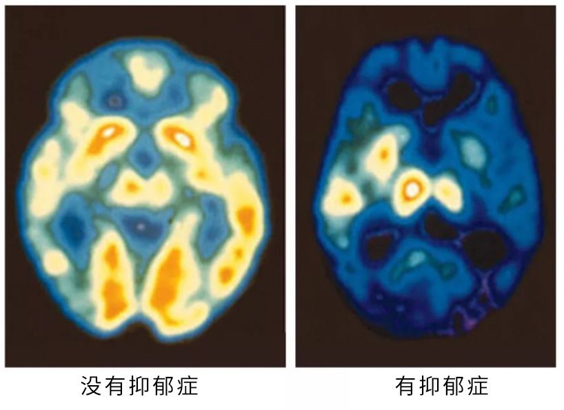 搜一搜 每个女性的乳晕上都有小凸起 这种小凸起被称为 "蒙哥马利腺"