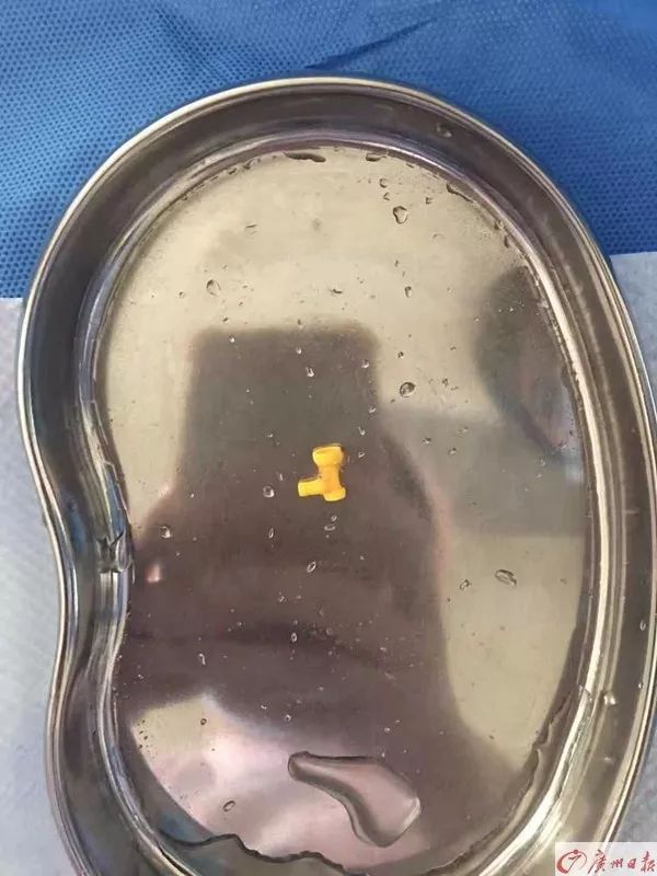                     女儿吞下一块玩具，结果妈妈被送进医院急救！只因这种错误操作……