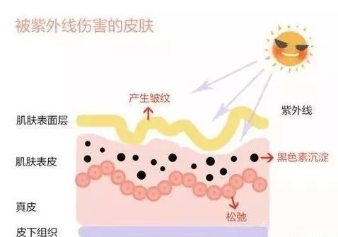 皮肤光老化