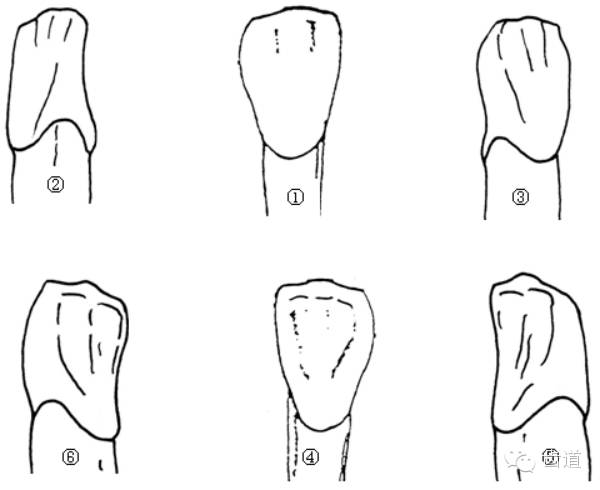 从唇侧看牙冠和牙根的移行部 牙根的形态 (六)下颌侧切牙的特征 ( 和