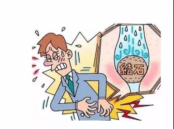 肾结石是吃出来的吗哪些情况可能是导致肾结石的诱因