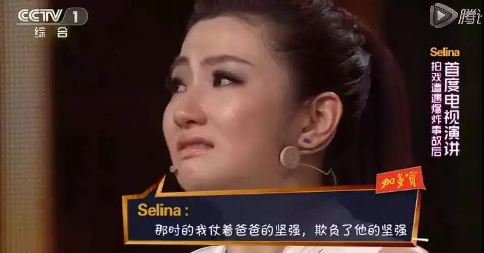 selina失声1年:"我被火烧,毁容,离婚,现在唱不了歌了.