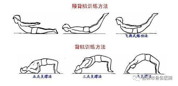 腰背肌功能锻炼的指导