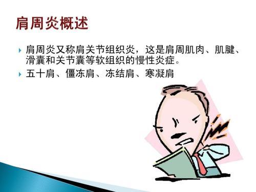 成语什么肩继踵_成语故事简笔画(2)