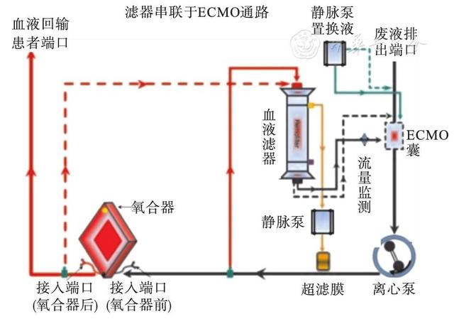 体外膜肺氧合ecmo是什么
