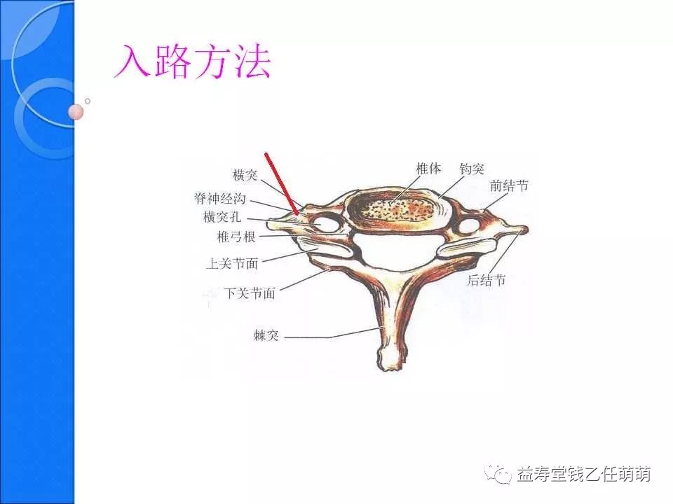 侧隐窝,椎间孔注射等临床实用技术