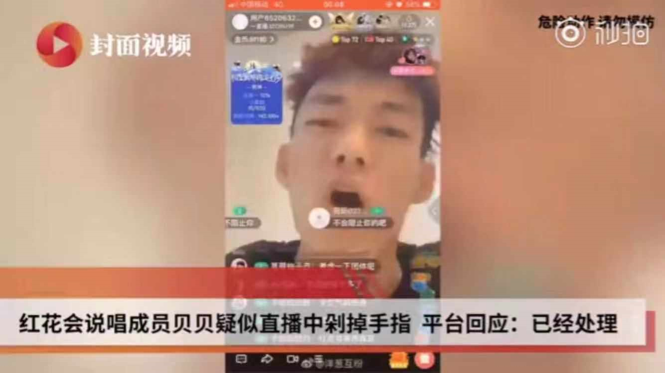 被质疑作假,暴躁男网红直播剁手指,平台回应来了!_贝贝