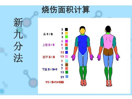 执业医师笔试考点烧伤面积计算方法