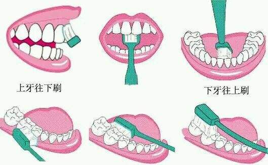 牙根部有一道槽怎么办