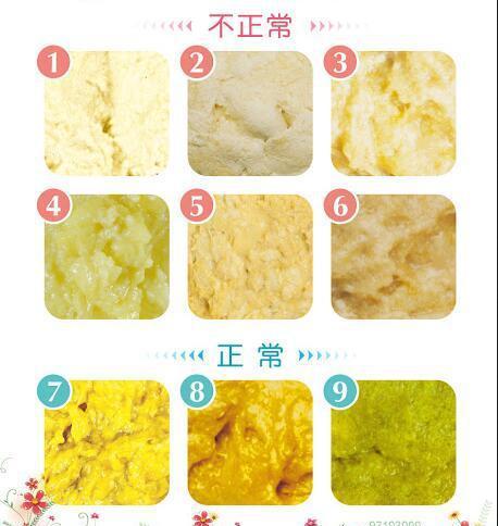                     【孕婴知识】宝宝便便全攻略，哪些便便不必担心？哪些便便需要注意？