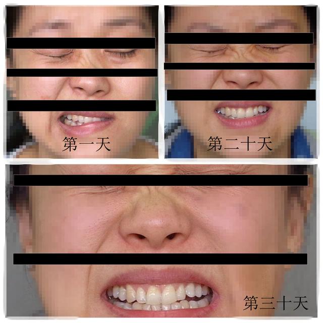 老年人口眼歪斜_老年人微信头像