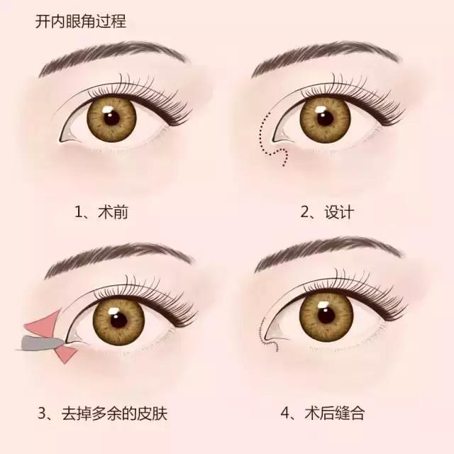 e20fc34c811c456f9dbdce1cb9b9a96a.jpeg