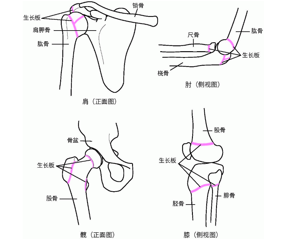 事实是,在胫骨,股骨和肱骨两端的生长板不会受到正常受控的重量举重