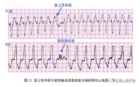 关于室速积分法本文非常全面了