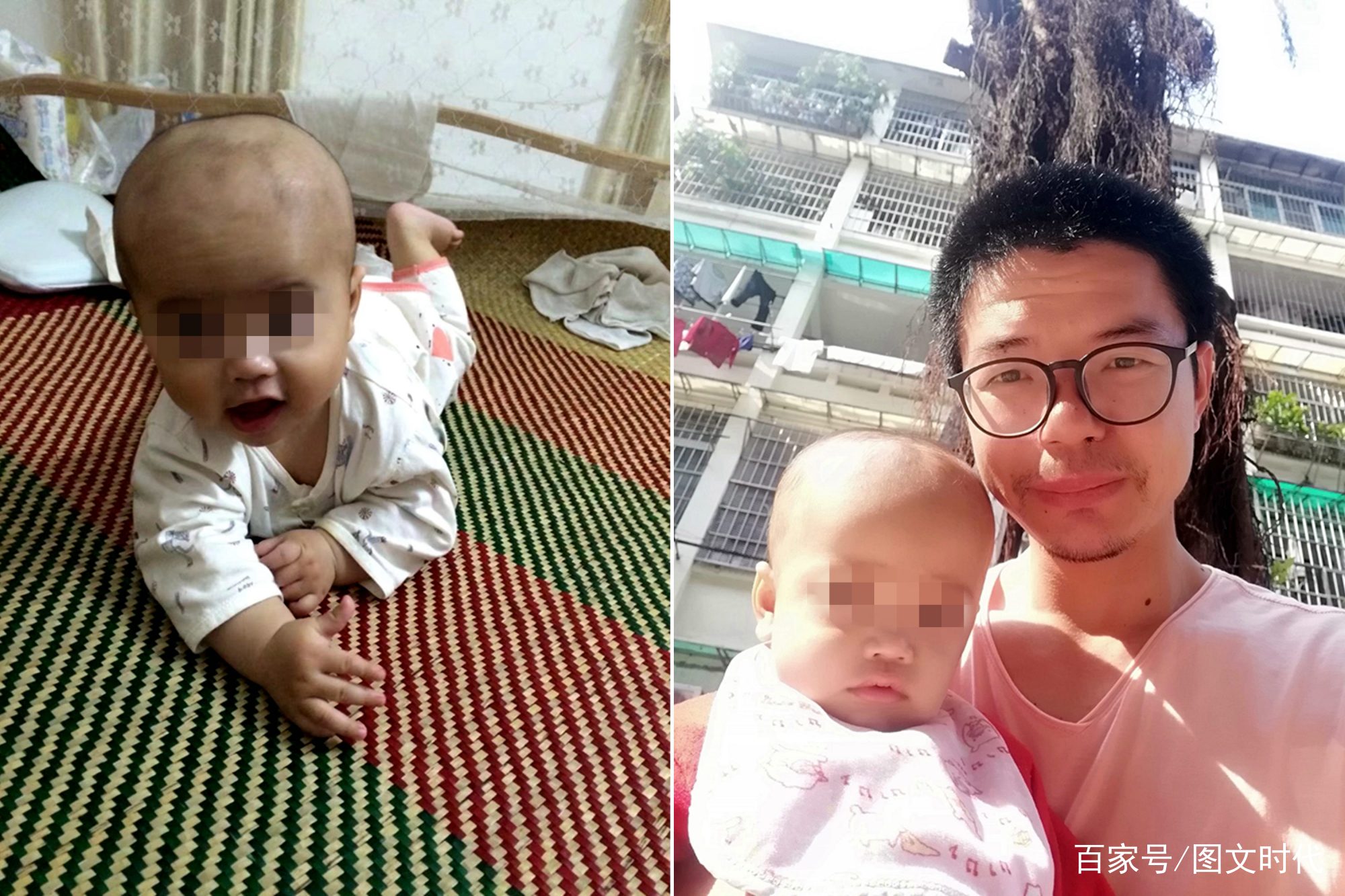                     男婴脸上长了一个红疙瘩，后被切除半张脸，10天后又确诊癌症