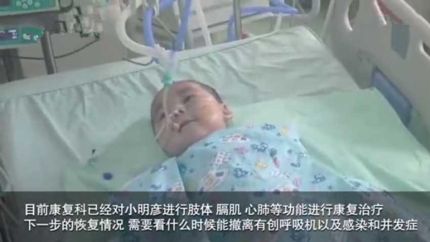                     PICU插管男婴的笑容感动了医生：那样的生命力，真的太有感染力了