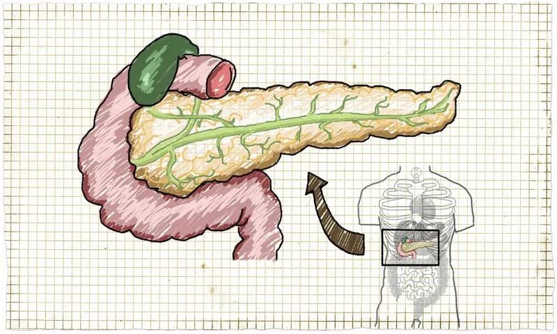 这种"肚子疼"别不当回事,可能要人命!_胰腺