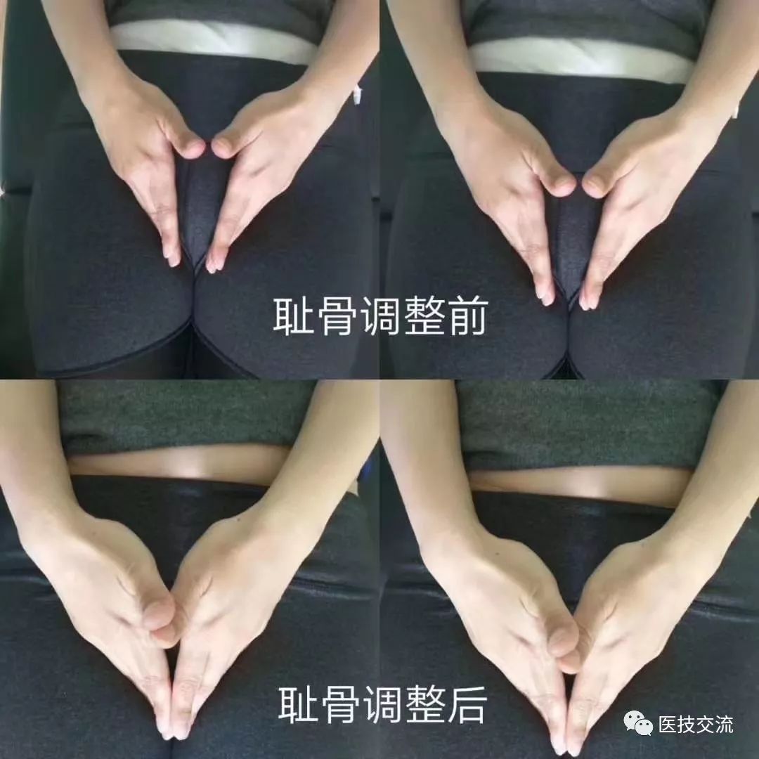 郑州9月12日徒手整形产后修复一指私密研修班
